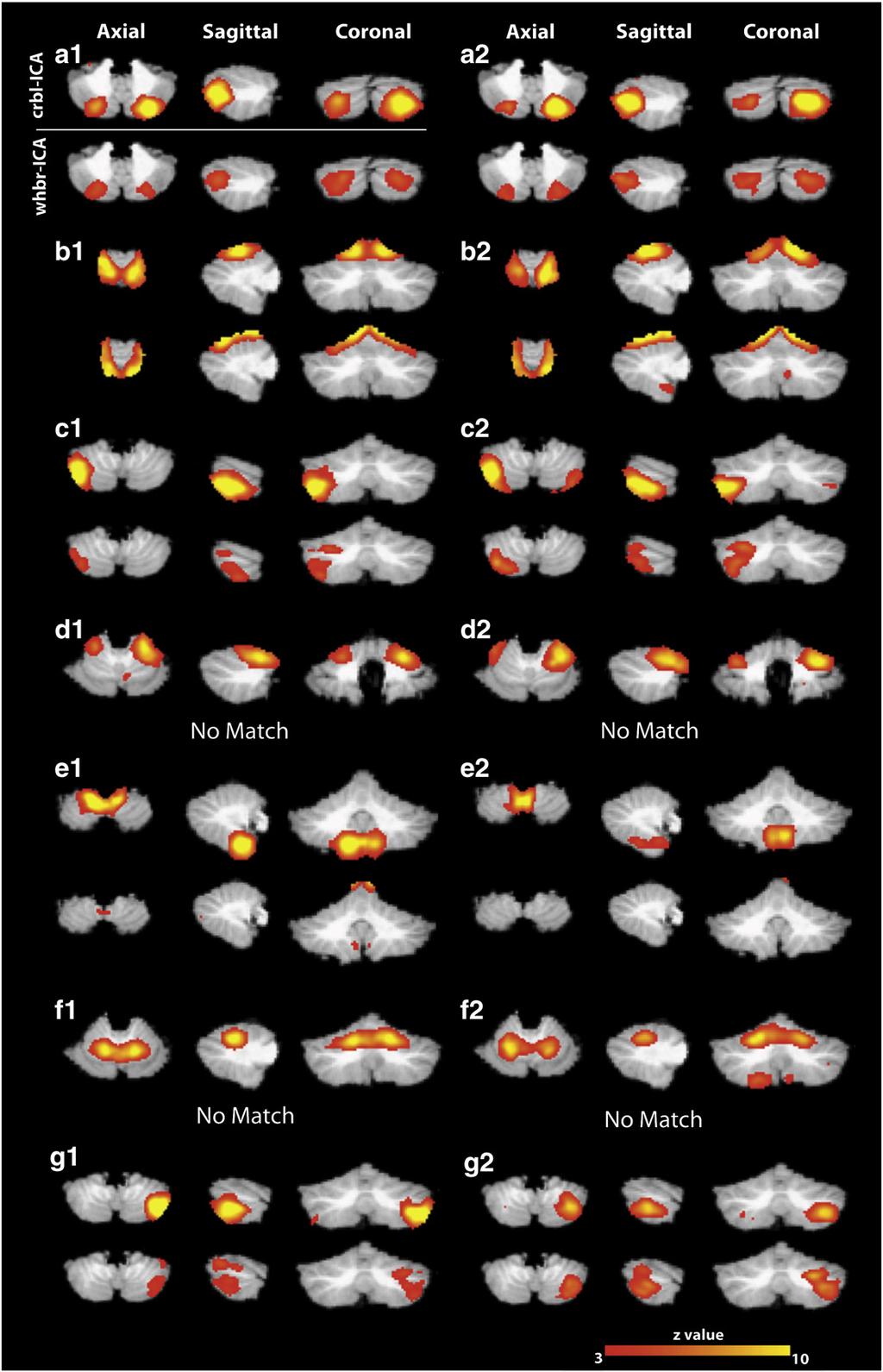 2078 V.I. Dobromyslin et al. / NeuroImage 60 (2012) 2073 2085 Fig. 5. Consistent group-level independent components in the cerebellum identified with the crbl-ica and the whbr-ica in Groups 1 and 2.