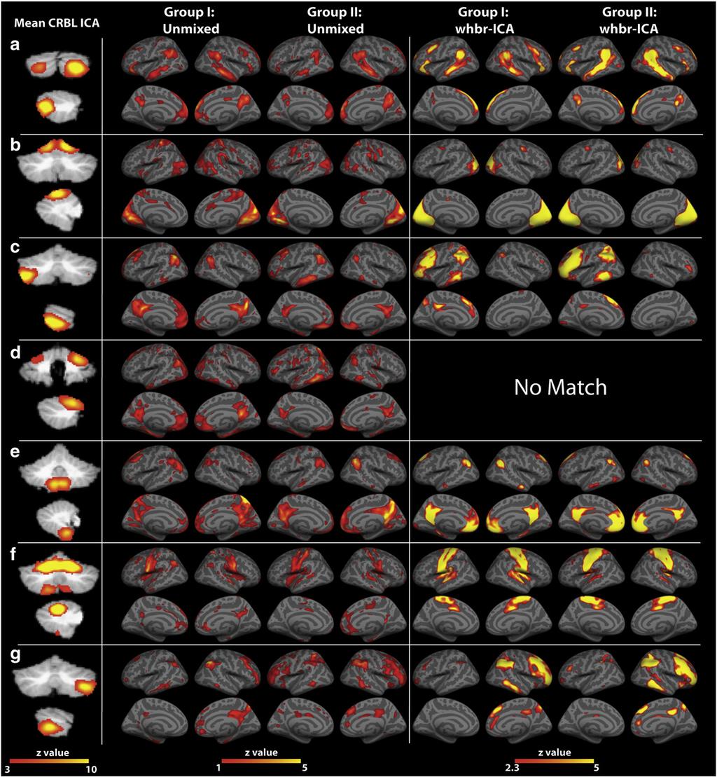 V.I. Dobromyslin et al. / NeuroImage 60 (2012) 2073 2085 2081 Fig. 8. Comparison of the unmixing results from crbl-ica to the whbr-ica.