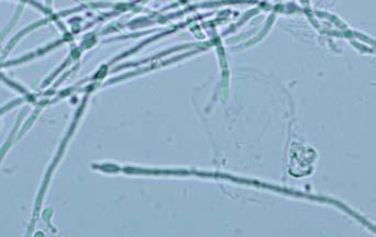 blastoconidia with no pseudohyphae formed