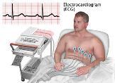 Electrocardiogram (12 Lead ECG) To assess: Ischemic changes, arrhythmias, left ventricular hypertrophy Monitoring for drug side effects or electrolyte imbalances Conduction abnormalities Bundle