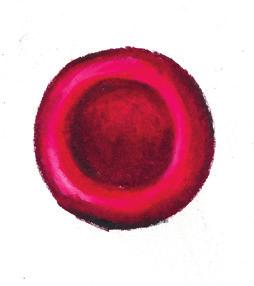 In people with sickle cell disease, the red blood cells can change into