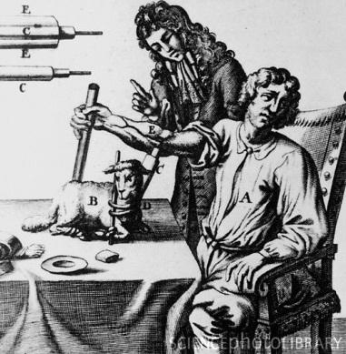 History of Transfusion Medicine 1628 English physician William Harvey discovers the circulation of blood. Shortly afterward, the earliest known blood transfusion is attempted.
