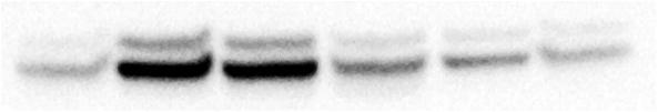 Supplemental Figure 7 A CXCL-1 perk1/2 44 KDa 42 KDa GAPDH 37 KDa Time (min) 0 5 15 30 60 90 B CXCL1