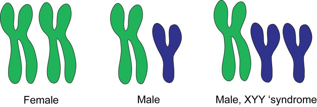 V. Chromosomal AlteraDons 1. Aneuploid Disorders d.