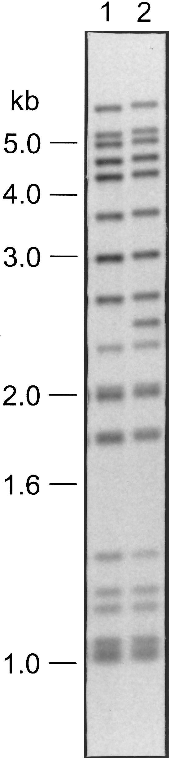 86 Agerton et al. CID 1999;29 (July) Figure 1. DNA fingerprints of Mycobacterium tuberculosis strains W and W1.