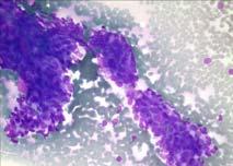 Histology: Basal cell