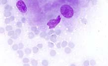 plasmocytoid/ spindle cells)