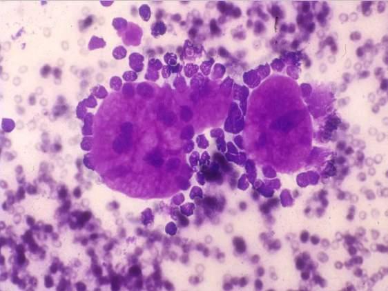 The diversity of salivary gland tumors creates a challenge for cytology: Effectiveness &