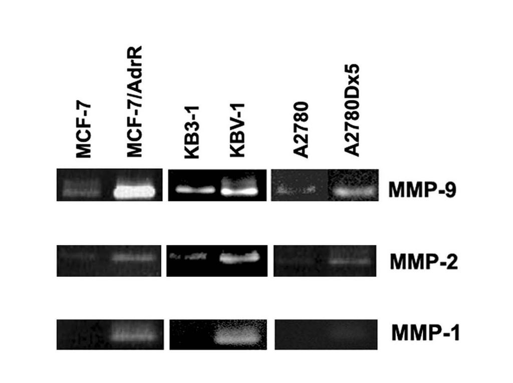Activity of MMP-9, MMP-2 and