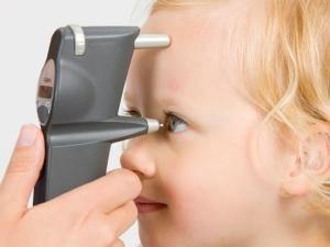 Aphakic Glaucoma Important and frequent complication of pediatric cataract