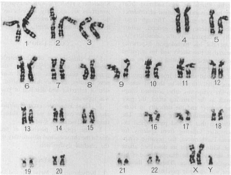 Chromosomal