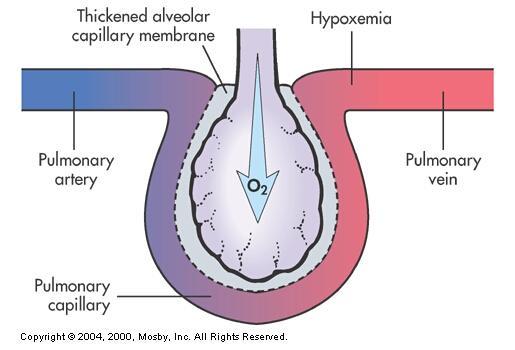 Diffusion Abnormality Abnormality of the alveolar
