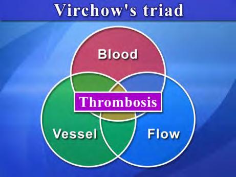 Thrombosis = intravital intravascular blood clotting Virchow s triad 1.