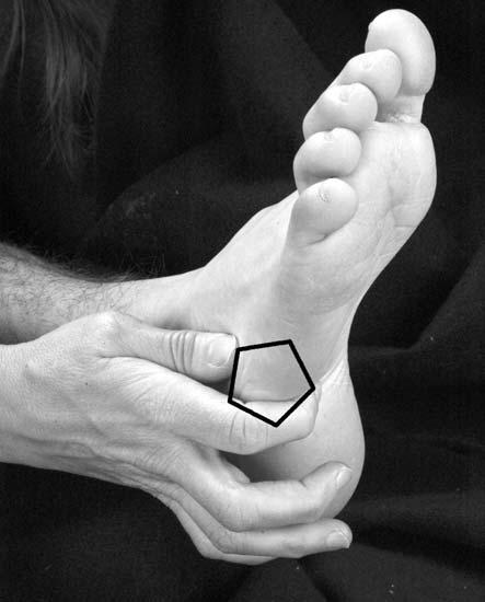 Pediatric Manual Medicine s0540 BALANCED LIGAMENTOUS TECHNIQUE s0550 Cuboid and Lateral Longitudinal Arch p0930 In most patients the lateral arch is dysfunctional or flattened.