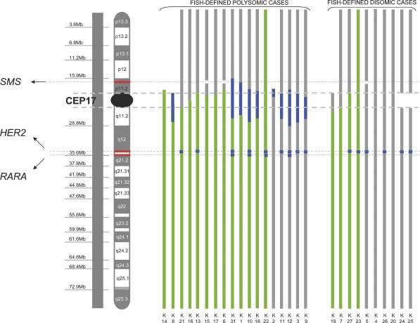 Does chromosome 17 centromere copy number predict polysomy in breast cancer?