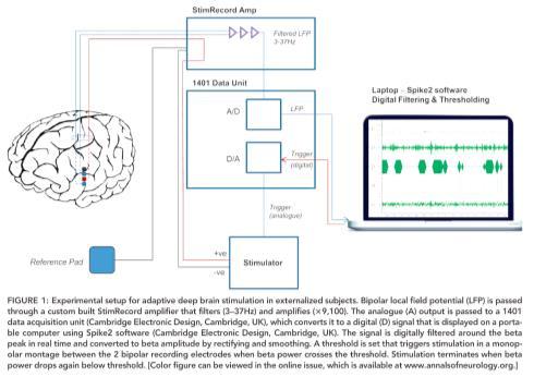 Closed Circuit Adaptive DBS Autopilot for DBS patients Brain radios allow
