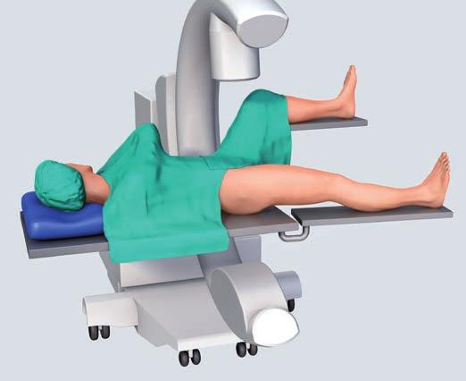 2 Position patient Place the patient in a supine position on the operating table.