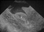bedside ultrasound