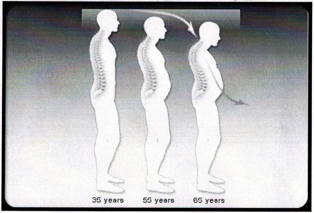 The mature skeleton gradually increases in mass during early adult life. Peak bone mass is achieved between 30 and 35 years of age.