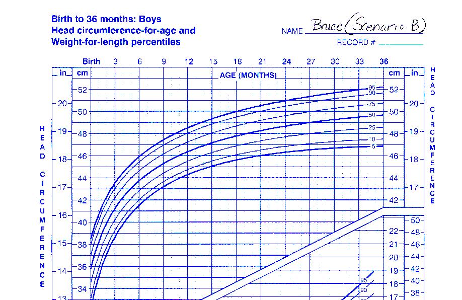 Bruce s Growth Birth Weight 8 lbs Length 20