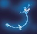 Laparoscopic Jejunostomy Can be chosen for patients with reflux or a suture line proximal to the stomach Usually will be