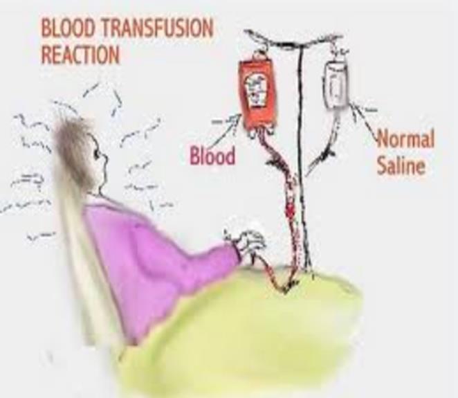 Acute Transfusion Reactions Stop and do not restart: Febrile Nonhemolytic Acute Hemolytic Transfusion Related Acute Lung Injury Anaphylactic Bacterial Contamination