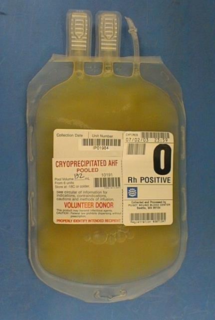 Kinds of Blood Components Whole Blood Donation RBC Platelet Plasma Cryoprecipitate