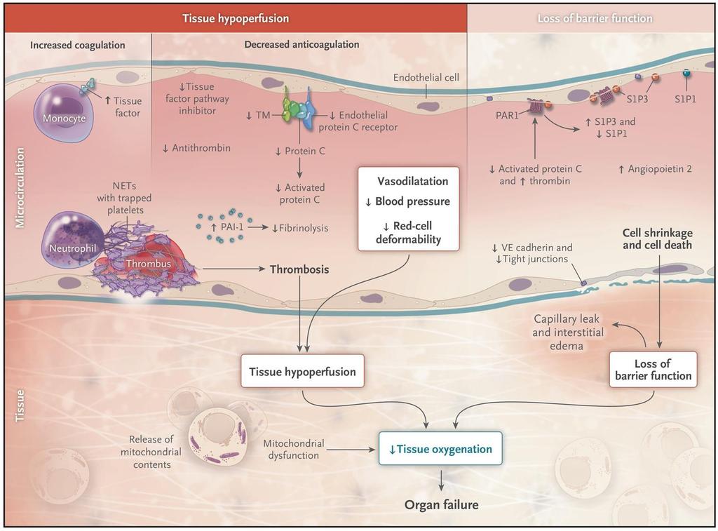 Organ Failure in Severe Sepsis and Dysfunction of the Vascular