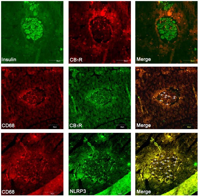 Fig. S4 Analyses of co-localization of CB 1 R and Nlrp3 with CD68+ macrophages and insulin+ beta cells in islets of ZDF rats.