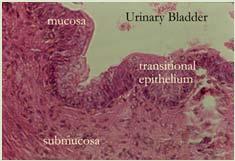 Transitinoal Epithelium 50 Muscularis Propria Submucosa Muscularis Externa Smooth Muscle Histology Urothelial Carcinoma =