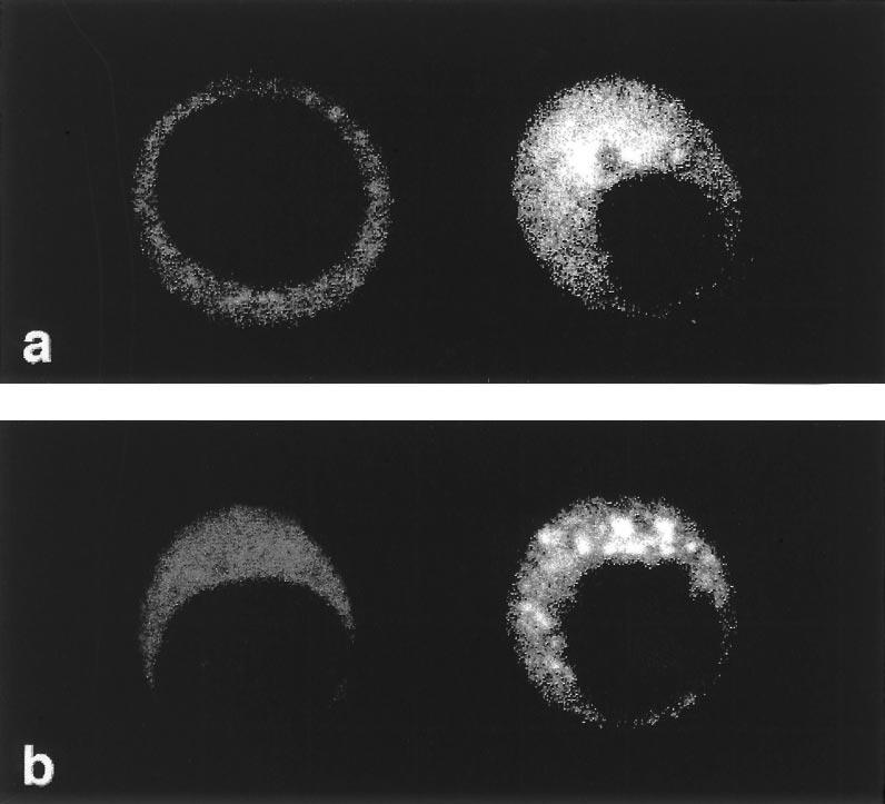 Evaluation of background staining in FISH with uninfected (left) and PV-infected (right) cells in the same microscopic field with a Texas red-labelled plus-strand-specific probe (a) and an
