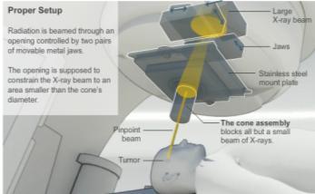 PINPOINT BEAM STRAYS INVISIBLY, HARMING INSTEAD OF HEALING By WALT BOGDANICH and KRISTINA REBELO Published: December 29, 2010 A fast-growing form of radiation therapy injures patients when its