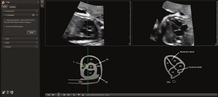 Turn images into answers This powerful architecture also supports automation designed to aid your workflow and increase your confidence in one of the most challenging exams the fetal heart.