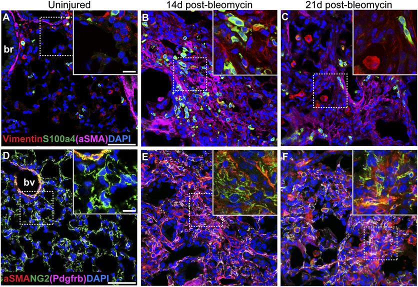 Supporting Information Rock et al. 10.1073/pnas.1117988108 Fig. S1. Heterogeneity of stromal cells in normal and fibrotic mouse lungs.