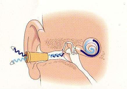 Speakers within the EOAE probe present tones through the ear canal, which has