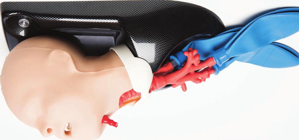 This model is ideal for a range of training including: Needle and surgical cricothyroidotomy Percutaneous