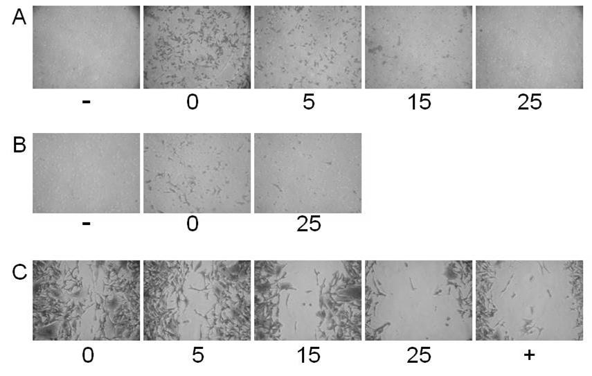 Figure 2-6. DIM inhibits in vitro metastasis in MDA-MB-231 cells. (A) Migration.