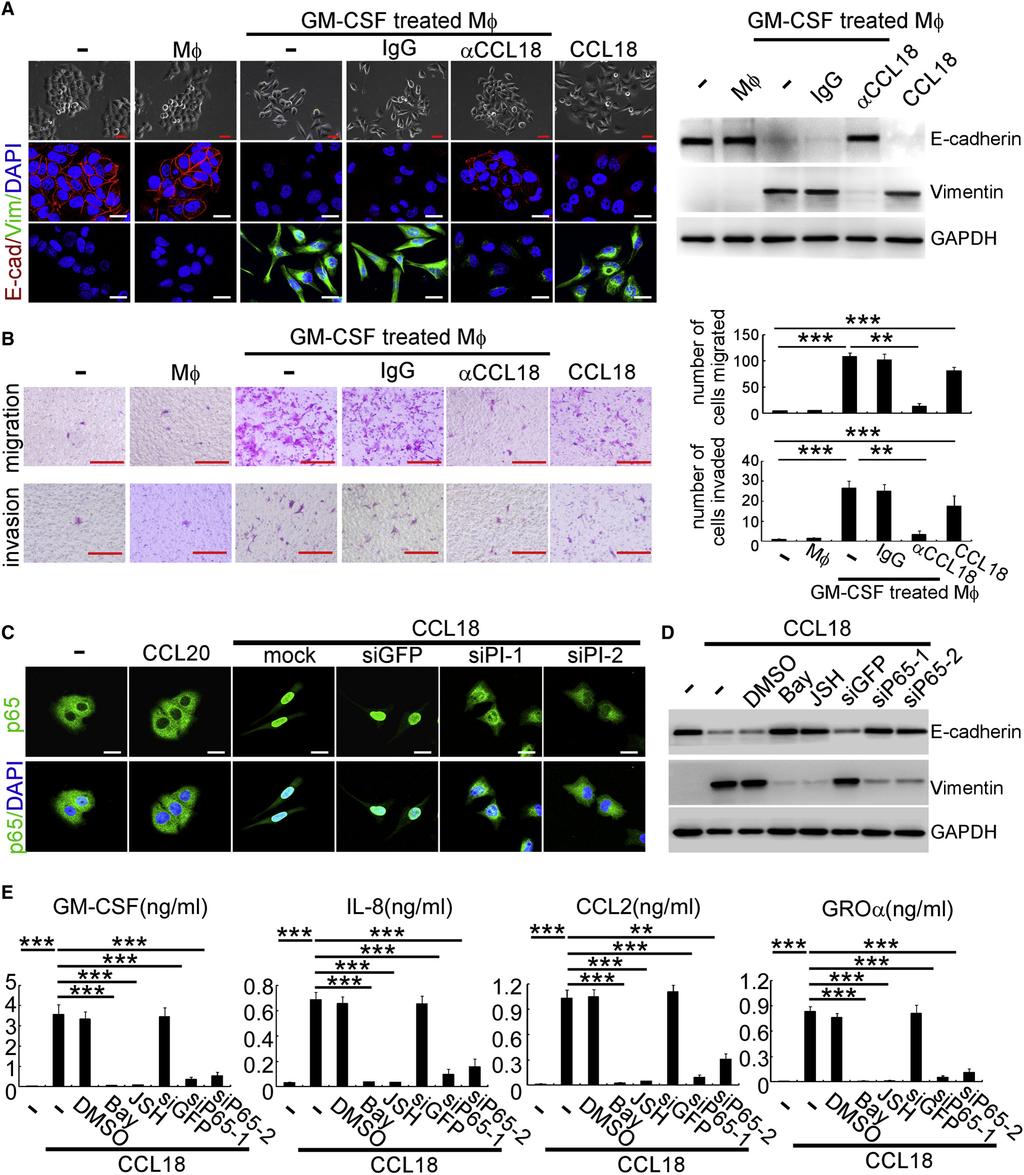 Cancer Cell GM-CSF-CCL18 Loop Promotes Breast Cancer Metastasis Figure 4.