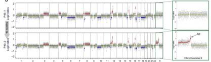 Low pass WGS for copy number detection in plasma Proof of principle in prostate cancer ctdna prescreening to facilitate rational choice of tumor genomic profiling