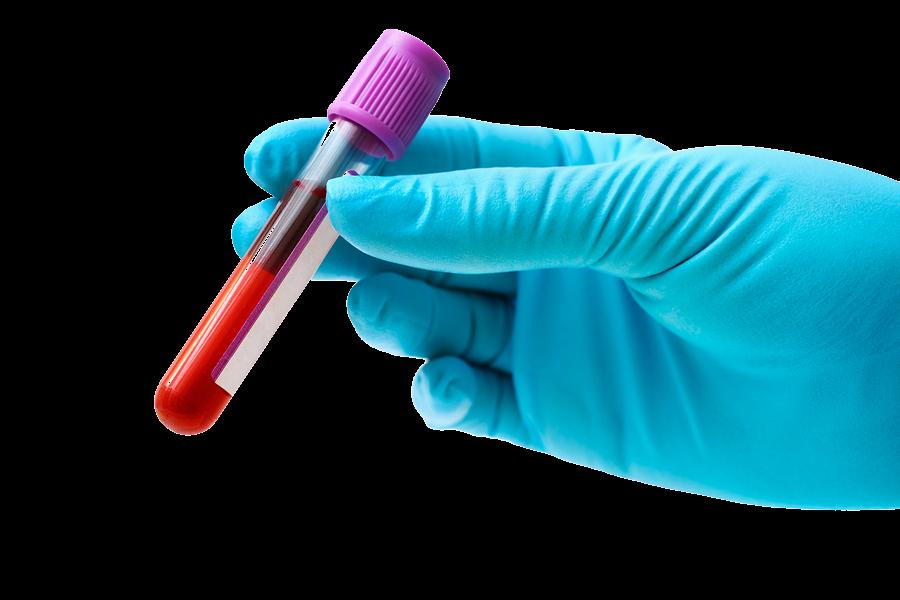 Bringing blood-based tests to large populations