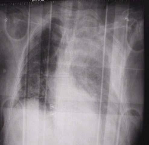 x-ray May 2009