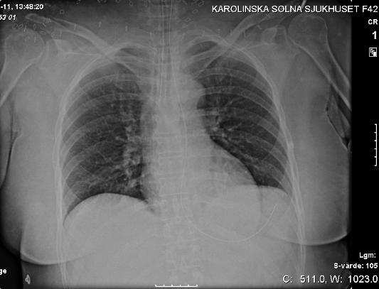 x-ray May 2009 