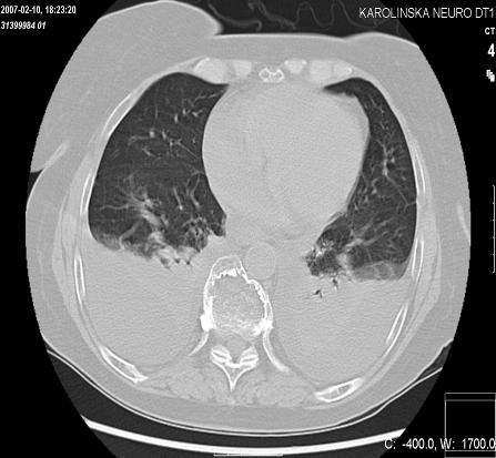 7Postoperative chest x-ray