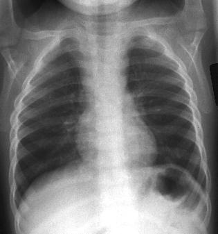 X-rays Failure to consider in adults Why Do We