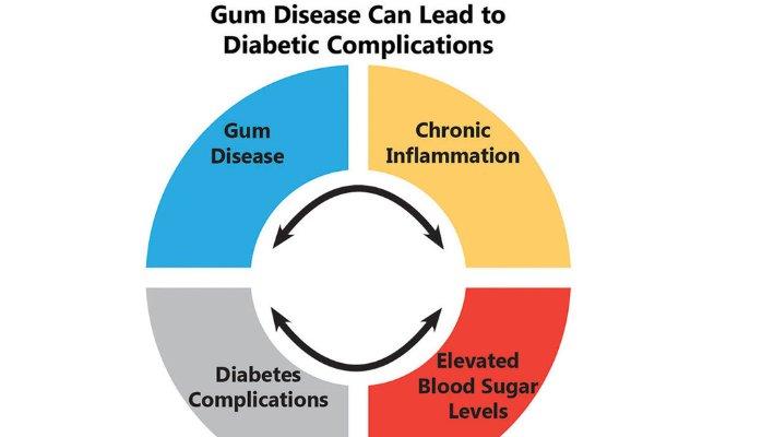 Gum Disease Risk Factors Poor plaque control Age Smoking/Tobacco Use Medication Stress Genetics Other Systemic