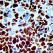 1 PTEN, RBT-PTEN Retinoblastoma 1F8 SALL4 6E3 SALL4, EP299 Stathmin, EP247 Vimentin V9 Vimentin, EP21 Endothelial ALDH1A1, EP168 CD31 1A10
