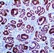 2 Epstein Barr Virus, CS1-4 LMP-1 Helicobacter pylori Helicobacter pylori BSB-37 Helicobacter pylori, EP279 Hepatitis B Virus Core Hepatitis B Virus Surface T9 Antigen Herpes Simplex Virus I Herpes