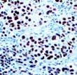 Pab101 Toxoplasma gondii Treponema Pallidum Varicella Zoster Virus SG1-1, SG1- SG4.