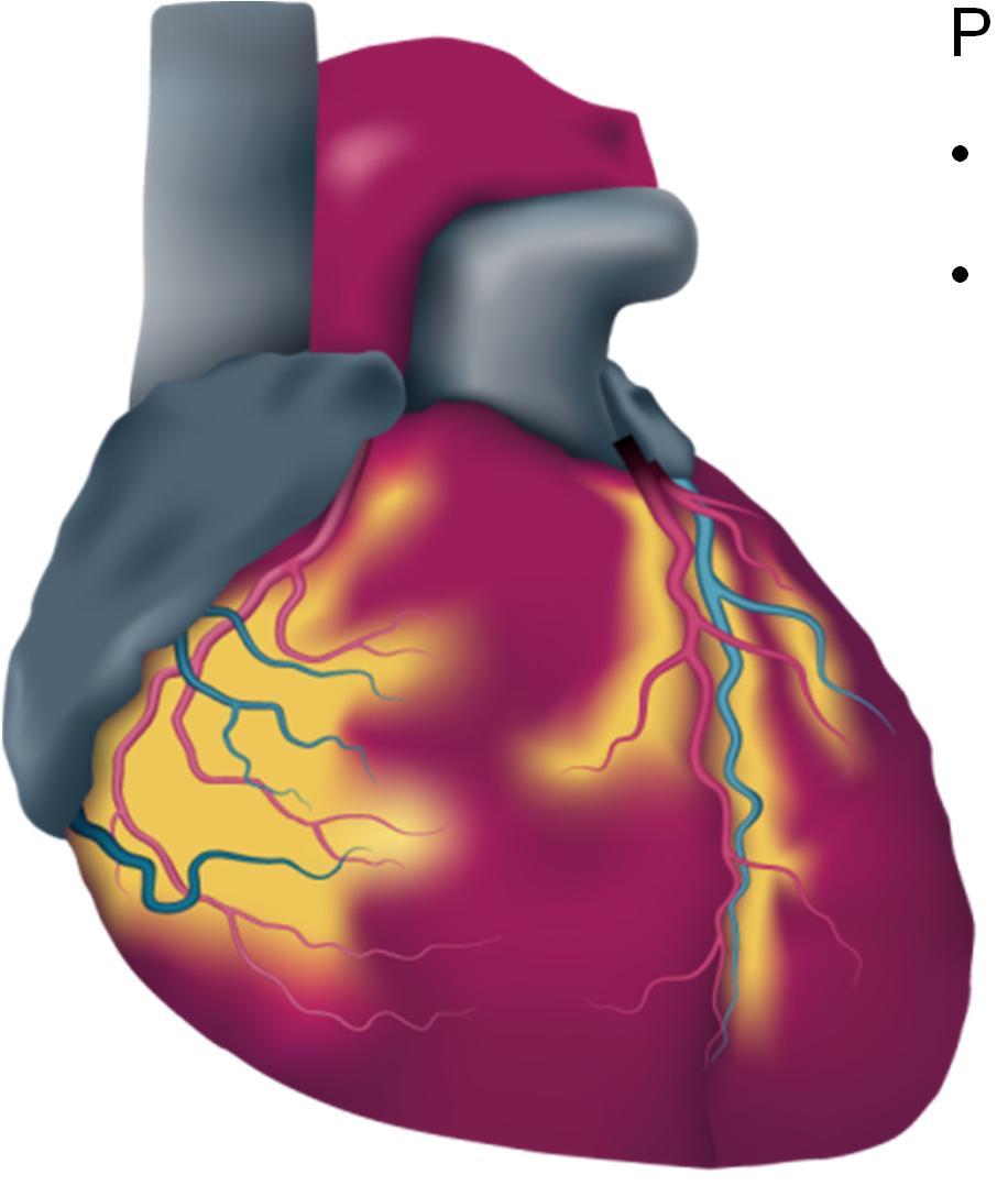 Cardiac Natriuret