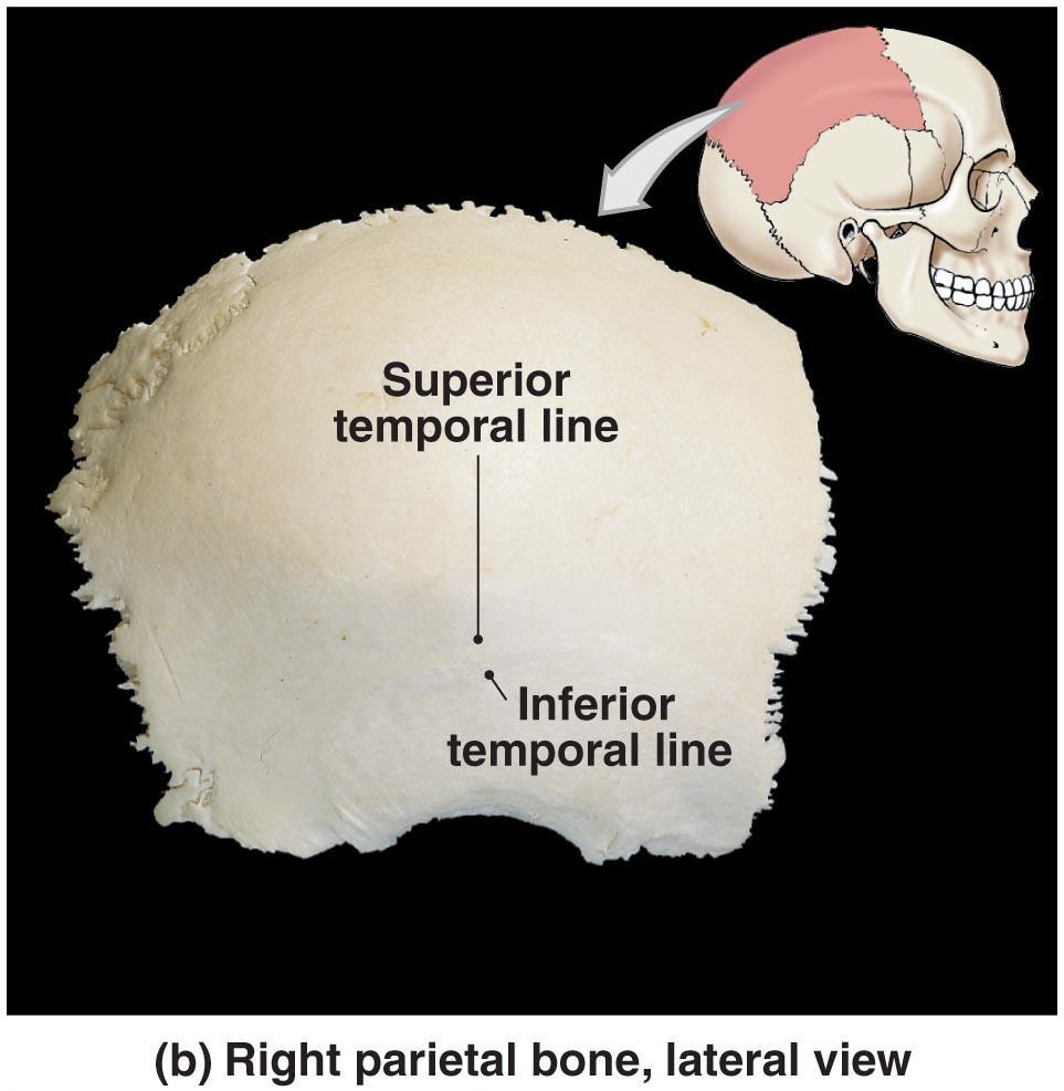 The parietal bones get their name because they form the wall of the